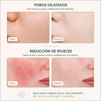 Tecnología LED para una Piel Perfecta. LedSkin Mask.