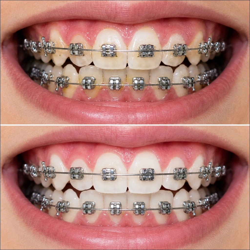 ¡Sonrisa de Cine en 2 Semanas! Irrigador Dental Pro.