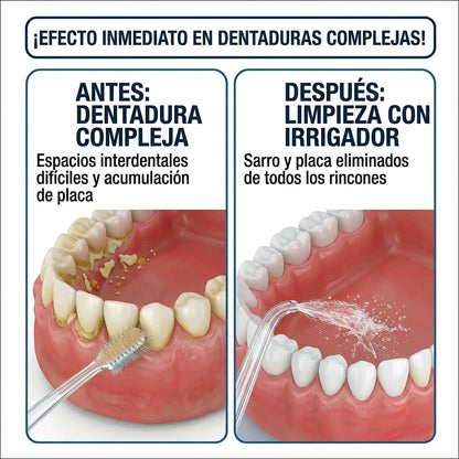 ¡Sonrisa de Cine en 2 Semanas! Irrigador Dental Pro.