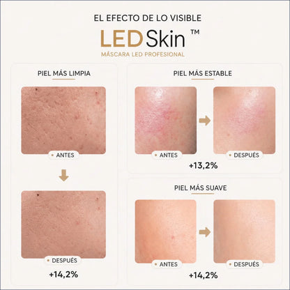 Tecnología LED para una Piel Perfecta. LedSkin Mask.